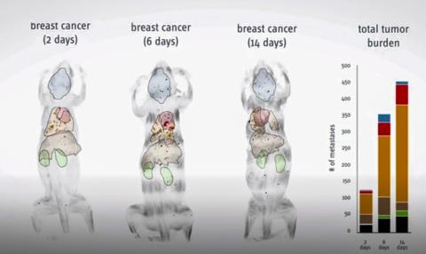 유방암에 걸린 쥐에서 시간이 지남에 따라 암이 전이된 모습. 동영상 캡처. ©Helmholtz Zentrum München