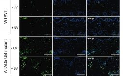 DNA 손상돼도 복제는 계속…암 억제 단백질 역할 밝혀